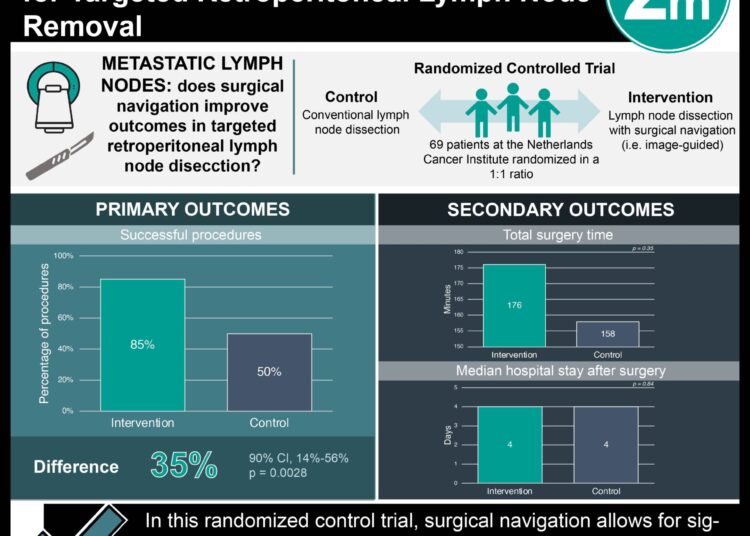 #VisualAbstract: Surgical Navigation Improves Outcomes for Targeted Retroperitoneal Lymph Node Removal