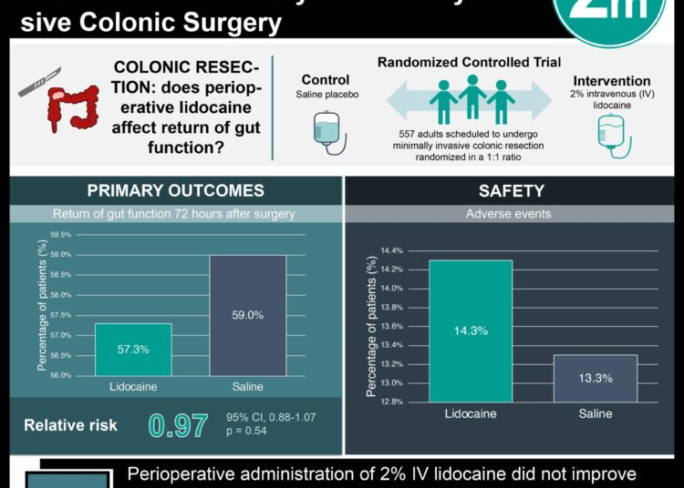 #VisualAbstract: Intravenous Lidocaine Does Not Improve Gut Function Recovery in Minimally Invasive Colonic Surgery