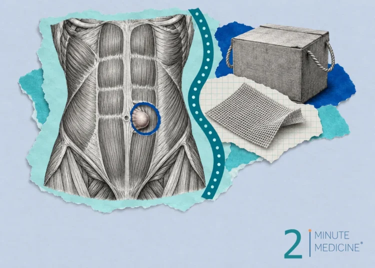 Collage of a belly muscle wall with a small hernia bulge circled, a square of surgical mesh and a cardboard box