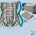 Collage of a belly muscle wall with a small hernia bulge circled, a square of surgical mesh and a cardboard box