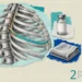 Shingles collage: an engraved spine and ribcage with one nerve traced in teal, a blank vaccine vial and a folded cloth