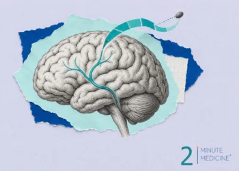 Ischemic stroke collage: an engraved brain with one artery traced in teal and a small clot lifted away on a ribbon